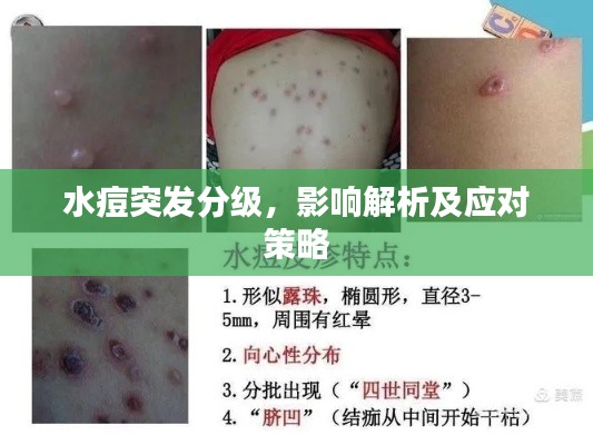 水痘突发分级，影响解析及应对策略